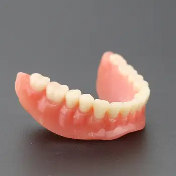 1Pc Dantų Dantų Studijų Modelį Overdenture Prastesnės 4 Implantas Demo Modelis 6002 02