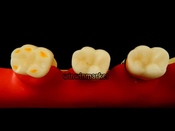 5 Etapas Stomatologas Odontologia Periodonto Ligų, Dantų, Dantų Modelio Dantų ZYR-4010