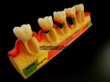 5 Etapas Stomatologas Odontologia Periodonto Ligų, Dantų, Dantų Modelio Dantų ZYR-4010