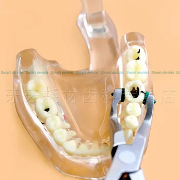 Aukštos Kokybės 2016 Naują Atvykimo šalinimo žnyples dantų ortodontinis replės ortodontinis medžiagos, įrankiai, nerūdijančio plieno Nemokamas Pristatymas