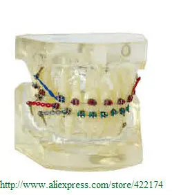 Nemokamas Pristatymas Periodontologija, gydymas modelis odontologia dantų mokymo dantį, dantų odontologas odontologijos Tyodont Modelis