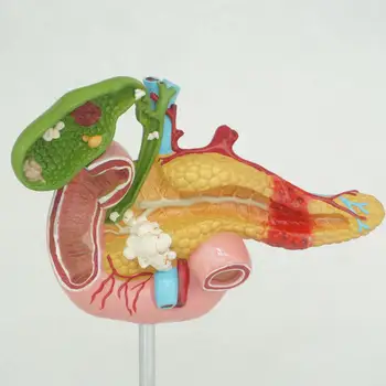 Žmogaus Anatomijos Dvylikapirštės Žarnos Tulžies Pūslės Ligos Anatomija Medicinos Mokymo Išteklių Modelis