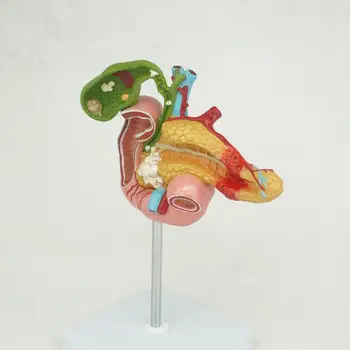Žmogaus Anatomijos Dvylikapirštės Žarnos Tulžies Pūslės Ligos Anatomija Medicinos Mokymo Išteklių Modelis